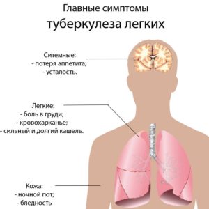 pulmonary-tuberculosis-symptoms